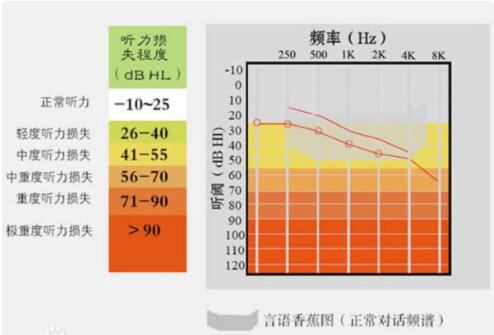 惠州医院测听力多少钱？听力检查哪些项目(图2)