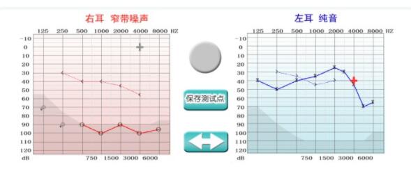 双耳存在听力损失，需要双耳都佩戴助听器吗？