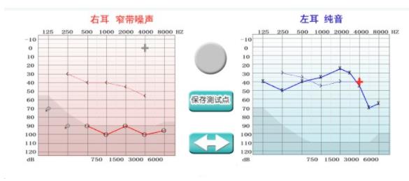 听力问题不及时干预原来这么严重