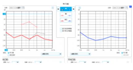 因听力导致了无法挽回的遗憾事