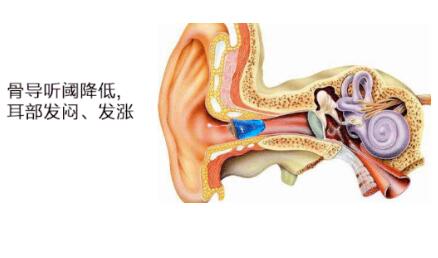 戴助听器感觉很闷,怎么办?