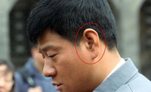 戴助听器能恢复听力吗？(图2)